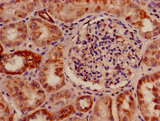 SLC33A1 Antibody - Immunohistochemistry of paraffin-embedded human kidney tissue using SLC33A1 Antibody at dilution of 1:100