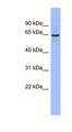 SLC34A3 / NaPi-2c Antibody - SLC34A3 antibody Western blot of COLO205 cell lysate. This image was taken for the unconjugated form of this product. Other forms have not been tested.