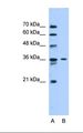 SLC35A3 Antibody - Lane A: Marker. Lane B: HepG2 cell lysate. Antibody concentration: 0.5 ug/ml. Gel concentration: 12%.  This image was taken for the unconjugated form of this product. Other forms have not been tested.