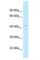 SLC35C2 Antibody - SLC35C2 antibody Western Blot of Mouse Liver. Antibody dilution: 1 ug/ml.  This image was taken for the unconjugated form of this product. Other forms have not been tested.