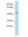SLC35G2 Antibody - SLC35G2 antibody Western Blot of Fetal Heart. Antibody dilution: 1 ug/ml.  This image was taken for the unconjugated form of this product. Other forms have not been tested.