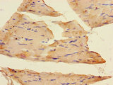 SLC37A1 Antibody - Immunohistochemistry of paraffin-embedded human skeletal muscle tissue using SLC37A1 Antibody at dilution of 1:100