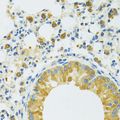 SLC37A4 / G6PT Antibody - Immunohistochemistry of paraffin-embedded mouse lung using SLC37A4 antibody at dilution of 1:100 (40x lens).