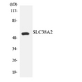 SLC38A2 / SNAT2 Antibody - Western blot analysis of the lysates from HeLa cells using SLC38A2 antibody.
