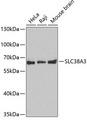 SLC38A3 / SNAT3 Antibody - Western blot analysis of extracts of various cell lines using SLC38A3 Polyclonal Antibody.