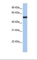 SLC38A9 Antibody - Jurkat cell lysate. Antibody concentration: 1.0 ug/ml. Gel concentration: 12%.  This image was taken for the unconjugated form of this product. Other forms have not been tested.