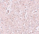 SLC39A13 / ZIP13 Antibody - Immunohistochemistry of ZIP13 in human spleen tissue with ZIP13 antibody at 2.5 ug/ml.