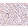 SLC39A2 / ZIP2 Antibody - Immunohistochemistry of ZIP2 in human brain tissue with ZIP2 antibody at 2.5 µg/mL.