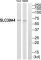 SLC39A4 / ZIP4 Antibody - Western blot analysis of lysates from CoLo and HepG2 cells using SLC39A4 Antibody. The lane on the right is blocked with the phospho peptide.