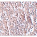 SLC39A5 / ZIP5 Antibody - Immunohistochemistry of ZIP5 in human spleen tissue with ZIP5 antibody at 2.5 µg/mL.