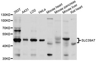 SLC39A7 / ZIP7 Antibody - Western blot analysis of extracts of various cell lines.