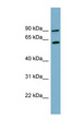 SLC3A1 / ATR1 Antibody - SLC3A1 antibody Western blot of PANC1 cell lysate. This image was taken for the unconjugated form of this product. Other forms have not been tested.