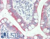 SLC41A1 Antibody - Anti-SLC41A1 antibody IHC staining of human small intestine. Immunohistochemistry of formalin-fixed, paraffin-embedded tissue after heat-induced antigen retrieval. Antibody concentration 10 ug/ml.  This image was taken for the unconjugated form of this product. Other forms have not been tested.