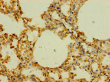 SLC43A3 Antibody - Immunohistochemistry of paraffin-embedded human lung tissue using SLC43A3 Antibody at dilution of 1:100