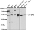 SLC46A2 Antibody - Western blot analysis of extracts of various cell lines, using SLC46A2 antibody at 1:1000 dilution. The secondary antibody used was an HRP Goat Anti-Rabbit IgG (H+L) at 1:10000 dilution. Lysates were loaded 25ug per lane and 3% nonfat dry milk in TBST was used for blocking. An ECL Kit was used for detection and the exposure time was 30s.
