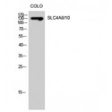 SLC4A8+10 Antibody - Western blot of SLC4A8/10 antibody