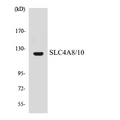 SLC4A8+10 Antibody - Western blot analysis of the lysates from HUVECcells using SLC4A8/10 antibody.