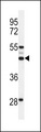 SLC51A / OSTalpha Antibody - Western blot of OST alpha Antibody in 293 cell line lysates (35 ug/lane). OST alpha (arrow) was detected using the purified antibody.