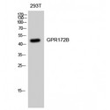 SLC52A1 / GPR172B / PAR2 Antibody - Western blot of GPR172B antibody