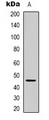 SLC52A2 / GPR172A / PAR1 Antibody - Western blot analysis of GPR172A expression in human brain (A) whole cell lysates.