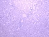 SLC5A1 / SGLT1 Antibody - Goat Anti-Slc5a1 (rat) Antibody Negative Control showing staining of paraffin embedded Human Liver, with no primary antibody.