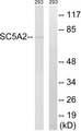 SLC5A2 / SGLT2 Antibody - Western blot analysis of lysates from 293 cells, using SLC5A2 Antibody. The lane on the right is blocked with the synthesized peptide.