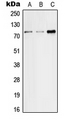 SLC5A2 / SGLT2 Antibody - Western blot analysis of SGLT2 expression in HeLa (A); SP2/0 (B); H9C2 (C) whole cell lysates.