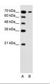 SLC5A4 / SGLT3 Antibody - A: Marker, B: Jurkat Cell Lysate.  This image was taken for the unconjugated form of this product. Other forms have not been tested.