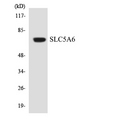 SLC5A6 / SMVT Antibody - Western blot analysis of the lysates from COLO205 cells using SLC5A6 antibody.