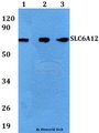 SLC6A12 / BGT-1 Antibody - Western blot of SLC6A12 antibody at 1:500 dilution. Lane 1: HEK293T whole cell lysate. Lane 2: sp2/0 whole cell lysate. Lane 3: PC12 whole cell lysate.