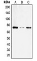 SLC6A14 Antibody - Western blot analysis of SLC6A14 expression in SKNMC (A); COLO205 (B); HL60 (C) whole cell lysates.