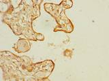 SLC6A16 Antibody - Immunohistochemistry of paraffin-embedded human placenta tissue using antibody at dilution of 1:100.