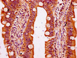 SLC6A19 Antibody - Immunohistochemistry Dilution at 1:300 and staining in paraffin-embedded human small intestine tissue performed on a Leica BondTM system. After dewaxing and hydration, antigen retrieval was mediated by high pressure in a citrate buffer (pH 6.0). Section was blocked with 10% normal Goat serum 30min at RT. Then primary antibody (1% BSA) was incubated at 4°C overnight. The primary is detected by a biotinylated Secondary antibody and visualized using an HRP conjugated SP system.