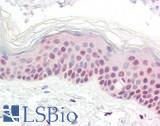 SLC6A2 / NET Antibody - Human Skin: Formalin-Fixed, Paraffin-Embedded (FFPE)