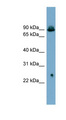 SLC6A5 / GLYT2 Antibody - SLC6A5 / GLYT2 antibody Western blot of PANC1 cell lysate. This image was taken for the unconjugated form of this product. Other forms have not been tested.