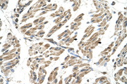 SLC6A8 Antibody - SLC6A8 antibody ARP42248_T100-NP_005620-SLC6A8(solute carrier family 6 (neurotransmitter transporter, creatine), member 8) Antibody IHC of formalin-fixed, paraffin-embedded human Muscle. Positive label: Skeletal muscle cells indicated with arrows. Antibody concentration 4-8 ug/ml. Magnification 400X.  This image was taken for the unconjugated form of this product. Other forms have not been tested.