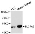 SLC7A9 / BAT1 Antibody - Western blot analysis of extracts of various cell lines, using SLC7A9 antibody at 1:3000 dilution. The secondary antibody used was an HRP Goat Anti-Rabbit IgG (H+L) at 1:10000 dilution. Lysates were loaded 25ug per lane and 3% nonfat dry milk in TBST was used for blocking. An ECL Kit was used for detection and the exposure time was 90s.