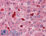 SLC8A3 / NCX3 Antibody - Anti-SLC8A3 antibody IHC of human liver. Immunohistochemistry of formalin-fixed, paraffin-embedded tissue after heat-induced antigen retrieval. Antibody concentration 5 ug/ml.  This image was taken for the unconjugated form of this product. Other forms have not been tested.