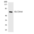 SLC8B1 / SLC24A6 / NCLX Antibody - Western blot analysis of the lysates from HeLa cells using SLC24A6 antibody.