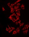 SLC8B1 / SLC24A6 / NCLX Antibody - Staining MCF-7 cells by IF/ICC. The samples were fixed with PFA and permeabilized in 0.1% Triton X-100, then blocked in 10% serum for 45 min at 25°C. The primary antibody was diluted at 1:200 and incubated with the sample for 1 hour at 37°C. An Alexa Fluor 594 conjugated goat anti-rabbit IgG (H+L) Ab, diluted at 1/600, was used as the secondary antibody.