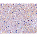 SLC9A1 / NHE1 Antibody - Immunohistochemical staining of human brain tissue using Nhe-1 antibody at 2.5 µg/mL.