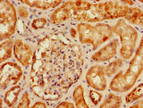 SLC9A3R2 / SIP1 Antibody - Immunohistochemistry of paraffin-embedded human kidney tissue using SLC9A3R2 Antibody at dilution of 1:100