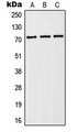 SLC9A6 Antibody - Western blot analysis of NHE6 expression in HEK293T (A); Raw264.7 (B); PC12 (C) whole cell lysates.