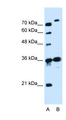 SLC9A7 Antibody - SLC9A7 antibody ARP44066_P050-NP_115980-SLC9A7(solute carrier family 9 (sodium/hydrogen exchanger), member 7) Antibody Western blot of Jurkat lysate.  This image was taken for the unconjugated form of this product. Other forms have not been tested.