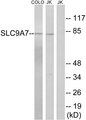 SLC9A7 Antibody - Western blot analysis of lysates from Jurkat and COLO cells, using SLC9A7 Antibody. The lane on the right is blocked with the synthesized peptide.