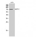 SLCO1B1 / OATP2 Antibody - Western blot of OATP-C antibody