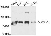 SLCO1C1 / OATPF Antibody - Western blot analysis of extracts of various cells.