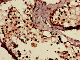 SLCO1C1 / OATPF Antibody - Immunohistochemistry of paraffin-embedded human testis tissue using SLCO1C1 Antibody at dilution of 1:100