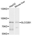 SLCO2B1 Antibody - Western blot analysis of extracts of various cell lines, using SLCO2B1 antibody at 1:1000 dilution. The secondary antibody used was an HRP Goat Anti-Rabbit IgG (H+L) at 1:10000 dilution. Lysates were loaded 25ug per lane and 3% nonfat dry milk in TBST was used for blocking. An ECL Kit was used for detection and the exposure time was 8s.