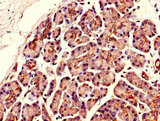 SLCO3A1 Antibody - Immunohistochemistry of paraffin-embedded human pancreatic tissue using SLCO3A1 Antibody at dilution of 1:100